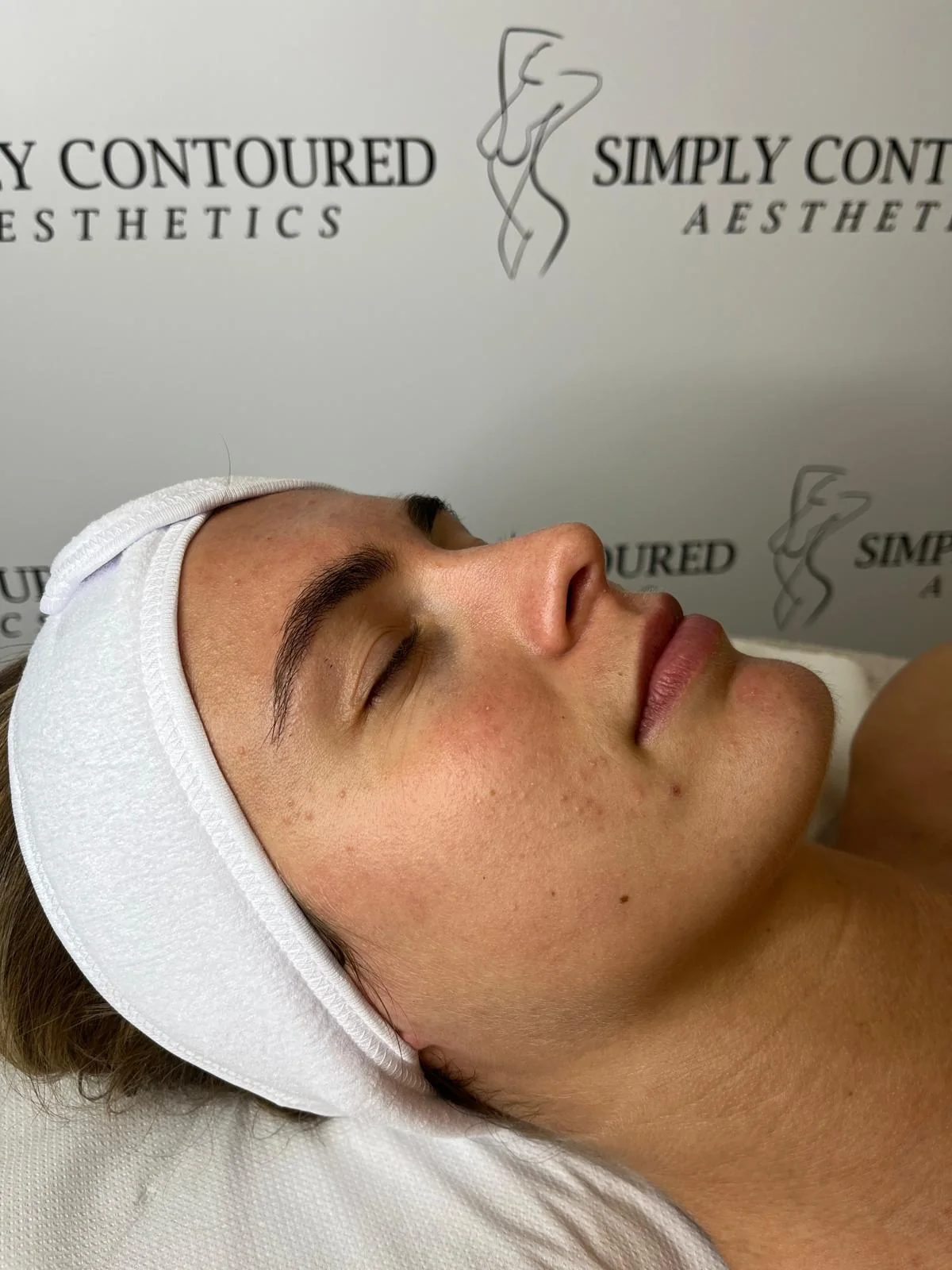 Lymphatic Drainage Facial at Simply Contoured, photo 2