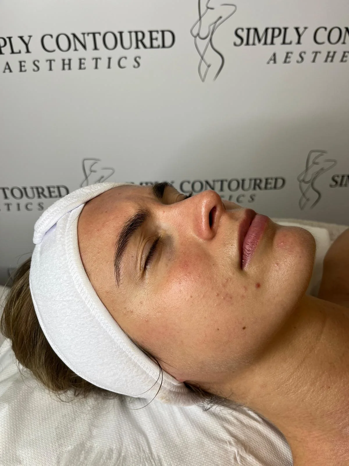Lymphatic Drainage Facial at Simply Contoured, photo 3