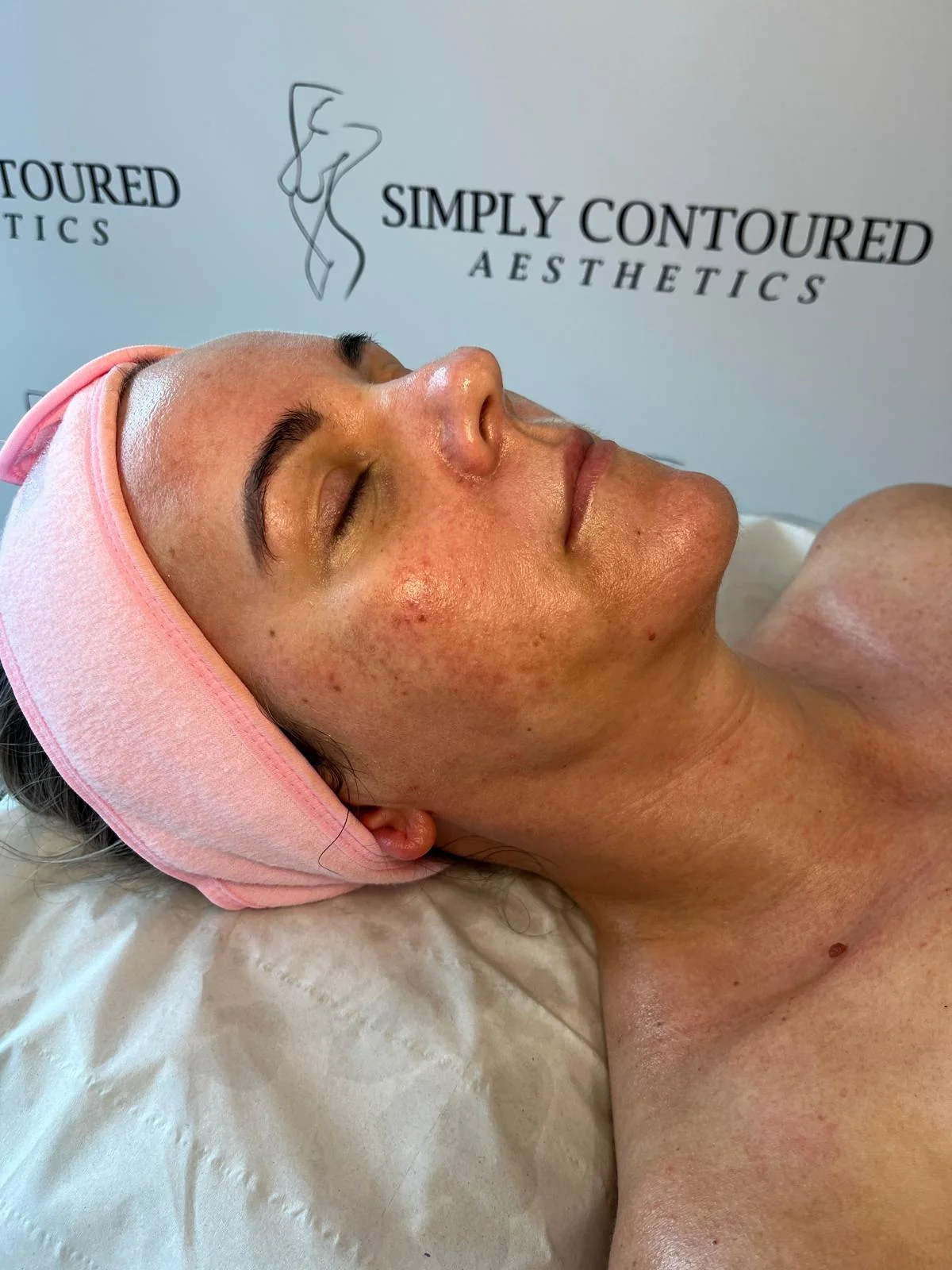 Lymphatic Drainage Facial at Simply Contoured, photo 4