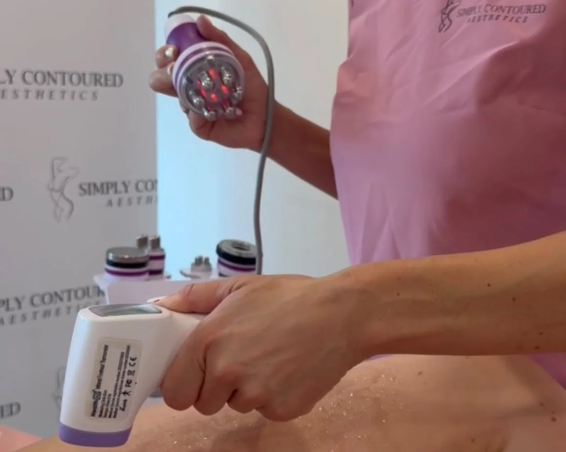 Radiofrequency and Cavitation